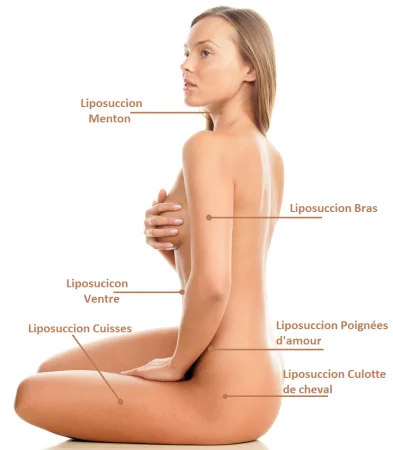 Procedure: Skin incisions